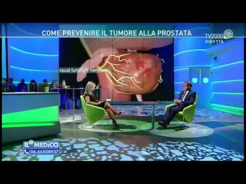 embolizzazione della prostata san camillo romania embolizzazione della prostata san camillo romania